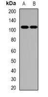 PNPLA3 / Adiponutrin Antibody - Western blot analysis of ADPN expression in HeLa (A); mouse testis (B) whole cell lysates.