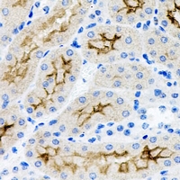 PNPLA3 / Adiponutrin Antibody - Immunohistochemical analysis of ADPN staining in human kidney formalin fixed paraffin embedded tissue section. The section was pre-treated using heat mediated antigen retrieval with sodium citrate buffer (pH 6.0). The section was then incubated with the antibody at room temperature and detected using an HRP conjugated compact polymer system. DAB was used as the chromogen. The section was then counterstained with hematoxylin and mounted with DPX.