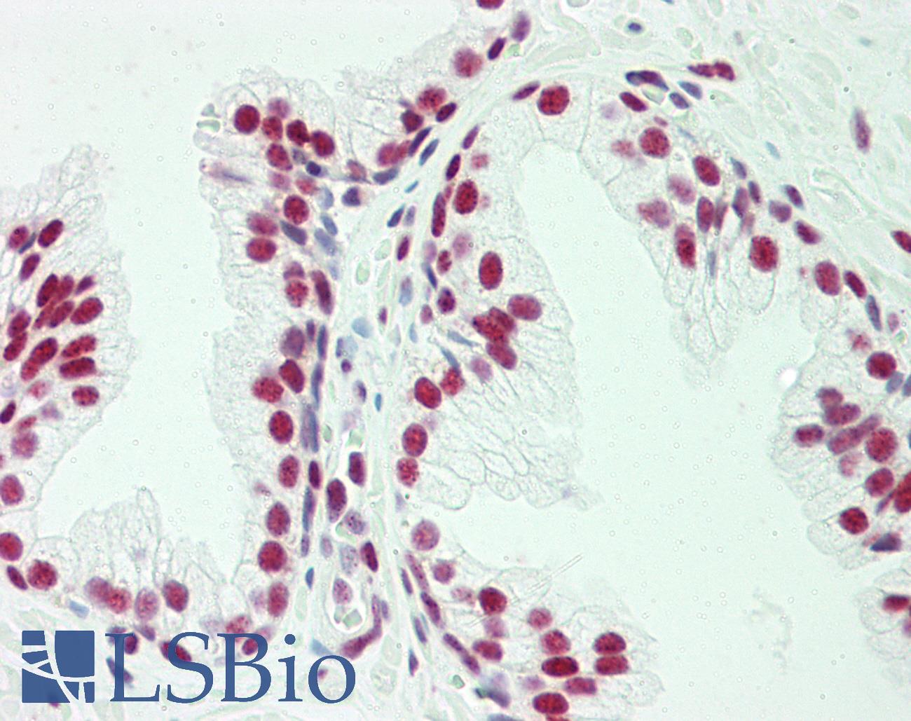 POGZ Antibody - Anti-POGZ antibody IHC staining of human prostate. Immunohistochemistry of formalin-fixed, paraffin-embedded tissue after heat-induced antigen retrieval. Antibody concentration 5 ug/ml.
