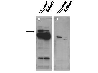 POGZ Antibody - Anti-Pogz Antibody - Western Blot. Western blot of affinity purified anti-Pogz antibody shows detection of Pogz protein (arrowhead) in adult mouse thymus and spleen tissue lysate (Panel A). The lower molecular weight bands may be cross reactive proteins. Pre-incubation of antibody with the immunizing peptide blocks specific antibody reactivity (Panel B). Primary antibody was used at 1:20000. Personal Communication, K. O. Gudmundsson and J. Keller, NCI, Frederick, MD.