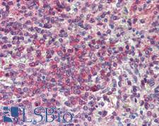 POLG Antibody - Human Spleen: Formalin-Fixed, Paraffin-Embedded (FFPE)