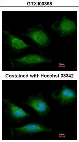 POLG Antibody - Immunofluorescence of methanol-fixed HeLa, using DNA polymerase gamma antibody at 1:200 dilution.