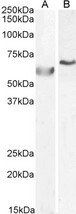 POLL / DNA Polymerase Lambda Antibody - Goat Anti-POLL / POLkappa Antibody (0.5µg/ml) staining of A549 (A) and (1ug/ul) HepG2 (B) cell lysate (35µg protein in RIPA buffer). Primary incubation was 1 hour. Detected by chemiluminescencence.