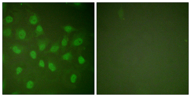 POLR2A / RNA polymerase II Antibody - Immunofluorescence analysis of HeLa cells, using POLR2A Antibody. The picture on the right is blocked with the synthesized peptide.