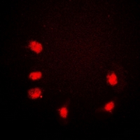 POLR2A / RNA polymerase II Antibody - Immunofluorescent analysis of Rpb1 CTD staining in HeLa cells. Formalin-fixed cells were permeabilized with 0.1% Triton X-100 in TBS for 5-10 minutes and blocked with 3% BSA-PBS for 30 minutes at room temperature. Cells were probed with the primary antibody in 3% BSA-PBS and incubated overnight at 4 deg C in a humidified chamber. Cells were washed with PBST and incubated with a DyLight 594-conjugated secondary antibody (red) in PBS at room temperature in the dark. DAPI was used to stain the cell nuclei (blue).
