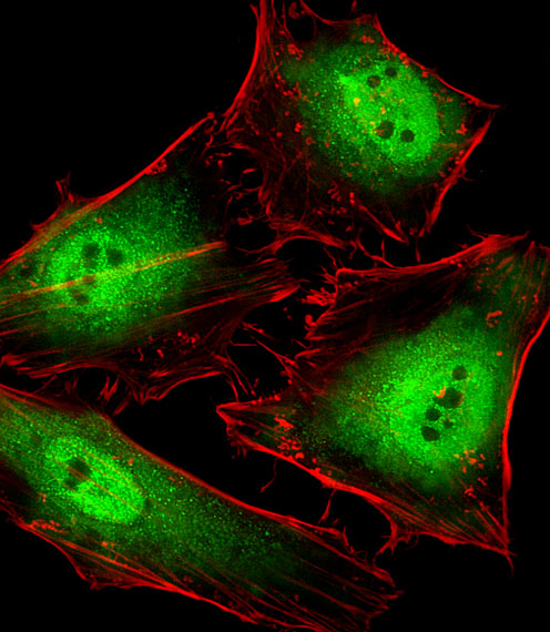 POLR2C Antibody - Fluorescent image of HeLa cells stained with POLR2C Antibody. Antibody was diluted at 1:25 dilution. An Alexa Fluor 488-conjugated goat anti-rabbit lgG at 1:400 dilution was used as the secondary antibody (green). Cytoplasmic actin was counterstained with Alexa Fluor 555 conjugated with Phalloidin (red).