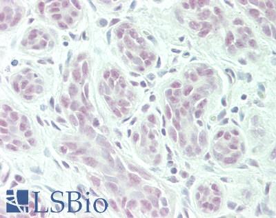 POLR2C Antibody - Human Breast: Formalin-Fixed, Paraffin-Embedded (FFPE)