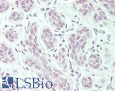 POLR2C Antibody - Human Breast: Formalin-Fixed, Paraffin-Embedded (FFPE)