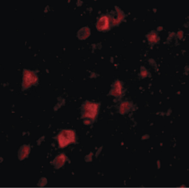 POLR3F Antibody - Immunofluorescence of POLR3F in human brain tissue with POLR3F antibody at 20 ug/ml.
