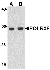 POLR3F Antibody - Western blot of POLR3F in human brain tissue lysate with POLR3F antibody at (A) 0.5 and (B) 1 ug/ml.