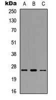 POLR3G Antibody - Western blot analysis of POLR3G expression in MCF7 (A); Raw264.7 (B); H9C2 (C) whole cell lysates.