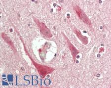 POLR3G Antibody - Human Brain, Cortex: Formalin-Fixed, Paraffin-Embedded (FFPE)