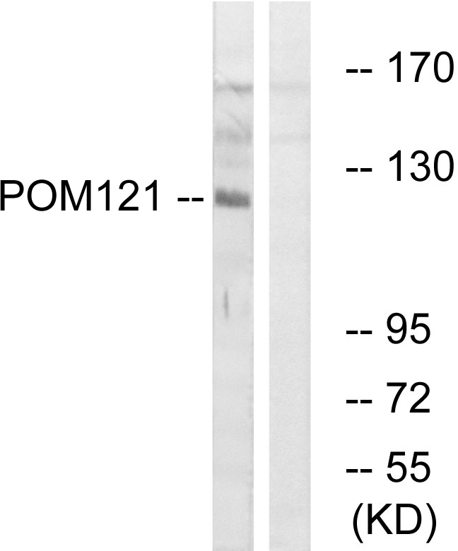 POM121 Antibody - Western blot analysis of lysates from K562 cells, using POM121 Antibody. The lane on the right is blocked with the synthesized peptide.