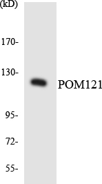 POM121 Antibody - Western blot analysis of the lysates from HUVECcells using POM121 antibody.