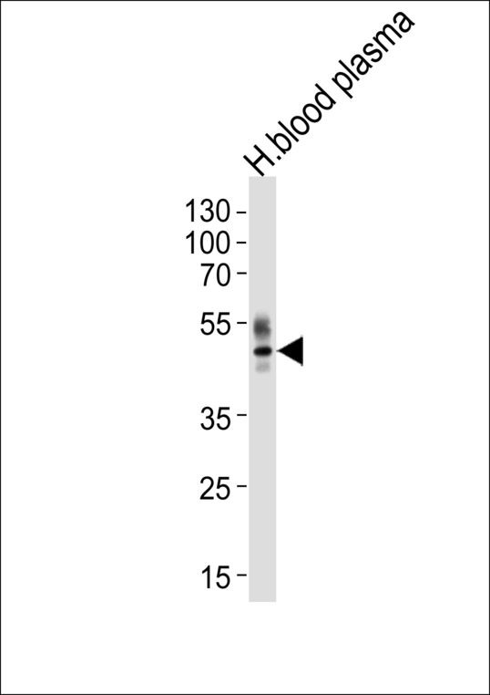 PON1 / ESA Antibody - Western blot of lysate from human blood plasma tissue lysate, using PON1 Antibody. Antibody was diluted at 1:1000 at each lane. A goat anti-rabbit IgG H&L (HRP) at 1:5000 dilution was used as the secondary antibody. Lysate at 35ug per lane.
