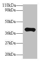 PON1 / ESA Antibody - Western blot All lanes: Serum paraoxonase/arylesterase 1 antibody at 2µg/ml + Mouse liver tissue Secondary Goat polyclonal to rabbit IgG at 1/10000 dilution Predicted band size: 40 kDa Observed band size: 40 kDa