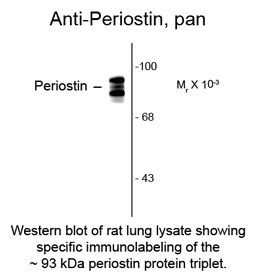 POSTN / Periostin Antibody