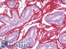 POSTN / Periostin Antibody - Human Breast: Formalin-Fixed, Paraffin-Embedded (FFPE)
