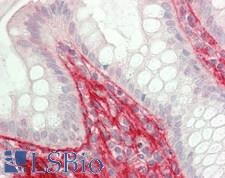 POSTN / Periostin Antibody - Human Colon: Formalin-Fixed, Paraffin-Embedded (FFPE)