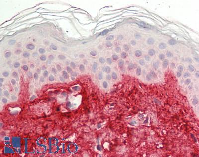 POSTN / Periostin Antibody - Human Skin: Formalin-Fixed, Paraffin-Embedded (FFPE)