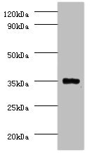 PP2CB / PPP2CB Antibody - Western blot All lanes: Serine/threonine-protein phosphatase 2A catalytic subunit beta isoform Antibody at 2µg/ml + EC109 whole cell lysate Secondary Goat polyclonal to rabbit IgG at 1/15000 dilution Predicted band size: 34 kDa Observed band size: 34 kDa