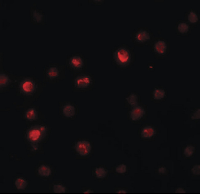 PPAPDC2 Antibody - Immunofluorescence of PPAPDC2 in Raji cells with PPAPDC2 antibody at 20 ug/ml.