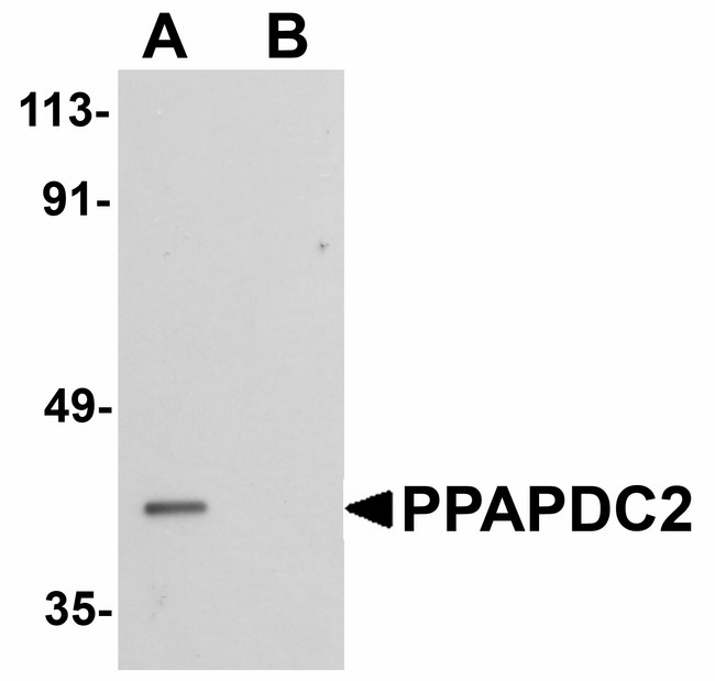 PPAPDC2 Antibody - Western blot of PPAPDC2 in Raji cell lysate with PPAPDC2 antibody at 1 ug/ml in (A) the absence and (B) the presence of blocking peptide.