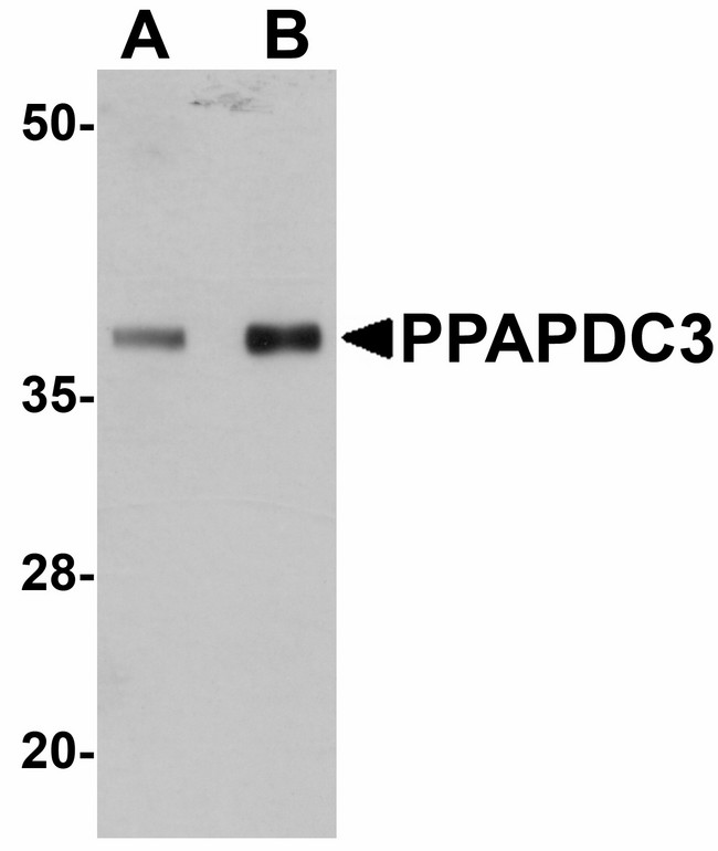 PPAPDC3 Antibody - Western blot of PPAPDC3 in mouse heart tissue lysate with PPAPDC3 antibody at (A) 1 and (B) 2 ug/ml.