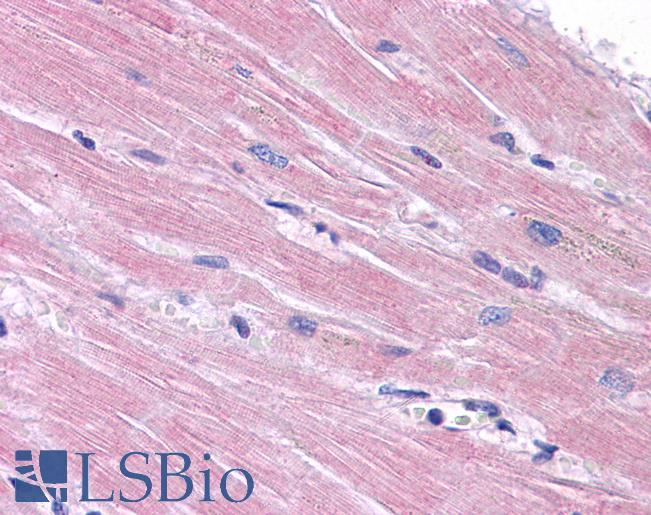 PPAPDC3 Antibody - Anti-PPAPDC3 antibody IHC of human heart. Immunohistochemistry of formalin-fixed, paraffin-embedded tissue after heat-induced antigen retrieval. Antibody concentration 5 ug/ml.