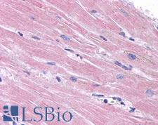 PPAPDC3 Antibody - Anti-PPAPDC3 antibody IHC of human heart. Immunohistochemistry of formalin-fixed, paraffin-embedded tissue after heat-induced antigen retrieval. Antibody concentration 5 ug/ml.