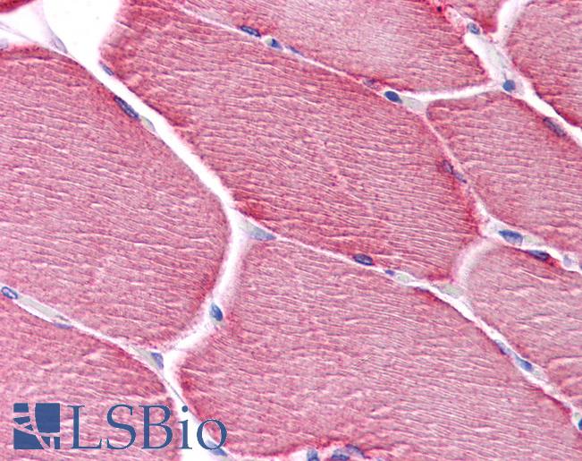 PPAPDC3 Antibody - Anti-PPAPDC3 antibody IHC of human skeletal muscle. Immunohistochemistry of formalin-fixed, paraffin-embedded tissue after heat-induced antigen retrieval. Antibody concentration 5 ug/ml.