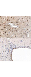 PPARA / PPAR Alpha Antibody - Immunohistochemistry using anti-PPAR antibody, showing staining of PPAR alpha in rat brain sections, highlighting cytoplasmic staining in ependymal cells and neurons in frontal cortex. Bottom image shows subventricular zone (svz) of lateral ventrical (exit point of progenitor olfactory neurons); top image shows frontal cortex in the same section. Cytoplasmic staining is also observed in the corpus callosum (bottom image) and in dendritic fields of the cortex. Formalin/PFA-fixed paraffin-embedded sections of rat brain tissue were incubated with the primary antibody at 1:200 for 1 hour. Antigen retrieval was performed by heat induction in citrate buffer pH 6.0.