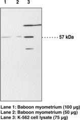 PPARA / PPAR Alpha Antibody - Western blot of PPAR Alpha antibody.