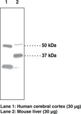 PPARD / PPAR Delta Antibody - Western blot of PPARD / PPAR Delta antibody.