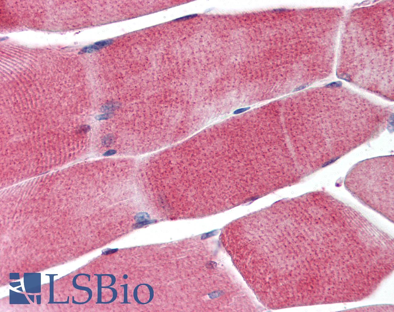 PPARG / PPAR Gamma Antibody - Anti-PPARG antibody IHC of human skeletal muscle. Immunohistochemistry of formalin-fixed, paraffin-embedded tissue after heat-induced antigen retrieval. Antibody concentration 5 ug/ml.