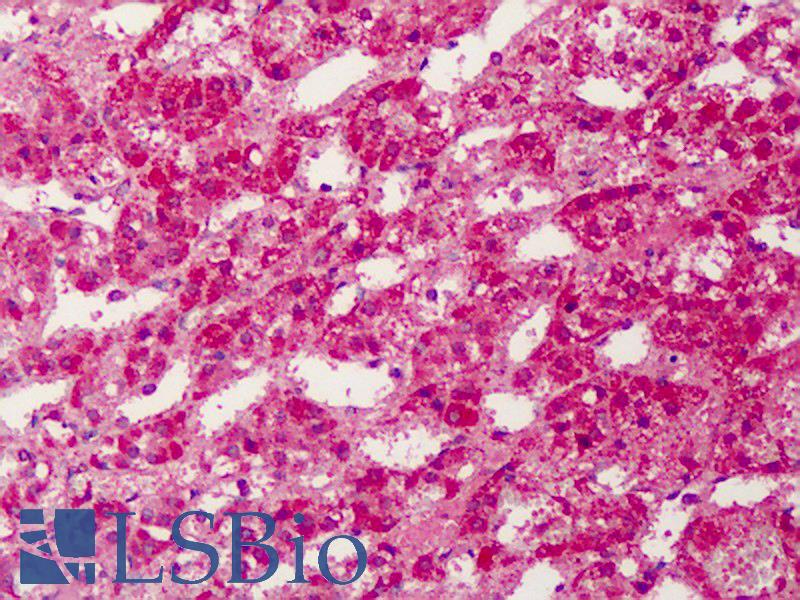 PPARG / PPAR Gamma Antibody - Anti-PPARG antibody IHC of human adrenal. Immunohistochemistry of formalin-fixed, paraffin-embedded tissue after heat-induced antigen retrieval. Antibody concentration 5 ug/ml.