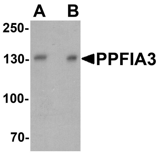 PPFIA3 Antibody - Western blot analysis of PPFIA3 in 293 cell lysate with PPFIA3 antibody at (A) 1 and (B) 2 ug/ml.
