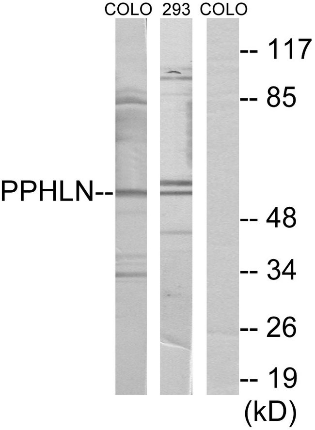 PPHLN1 Antibody - Western blot analysis of lysates from COLO and 293 cells, using PPHLN Antibody. The lane on the right is blocked with the synthesized peptide.