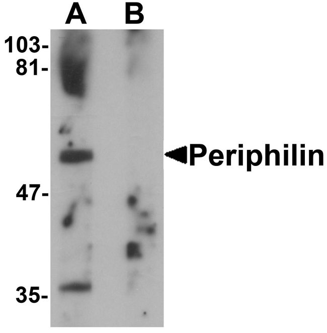 PPHLN1 Antibody - Western blot analysis of Periphilin in mouse colon tissue lysate with Periphilin antibody at 1 ug/ml in (A) the absence and (B) the presence of blocking peptide.
