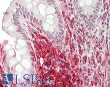PPIA / Cyclophilin A Antibody - Human Colon: Formalin-Fixed, Paraffin-Embedded (FFPE)