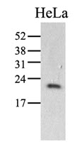 PPIC / Cyclophilin C Antibody - Western Blot: The HeLa (40 ug) were resolved by SDS-PAGE, transferred to PVDF membrane and probed with anti-human PPIC antibody (1:1000). Proteins were visualized using a goat anti-mouse secondary antibody conjugated to HRP and an ECL detection system.