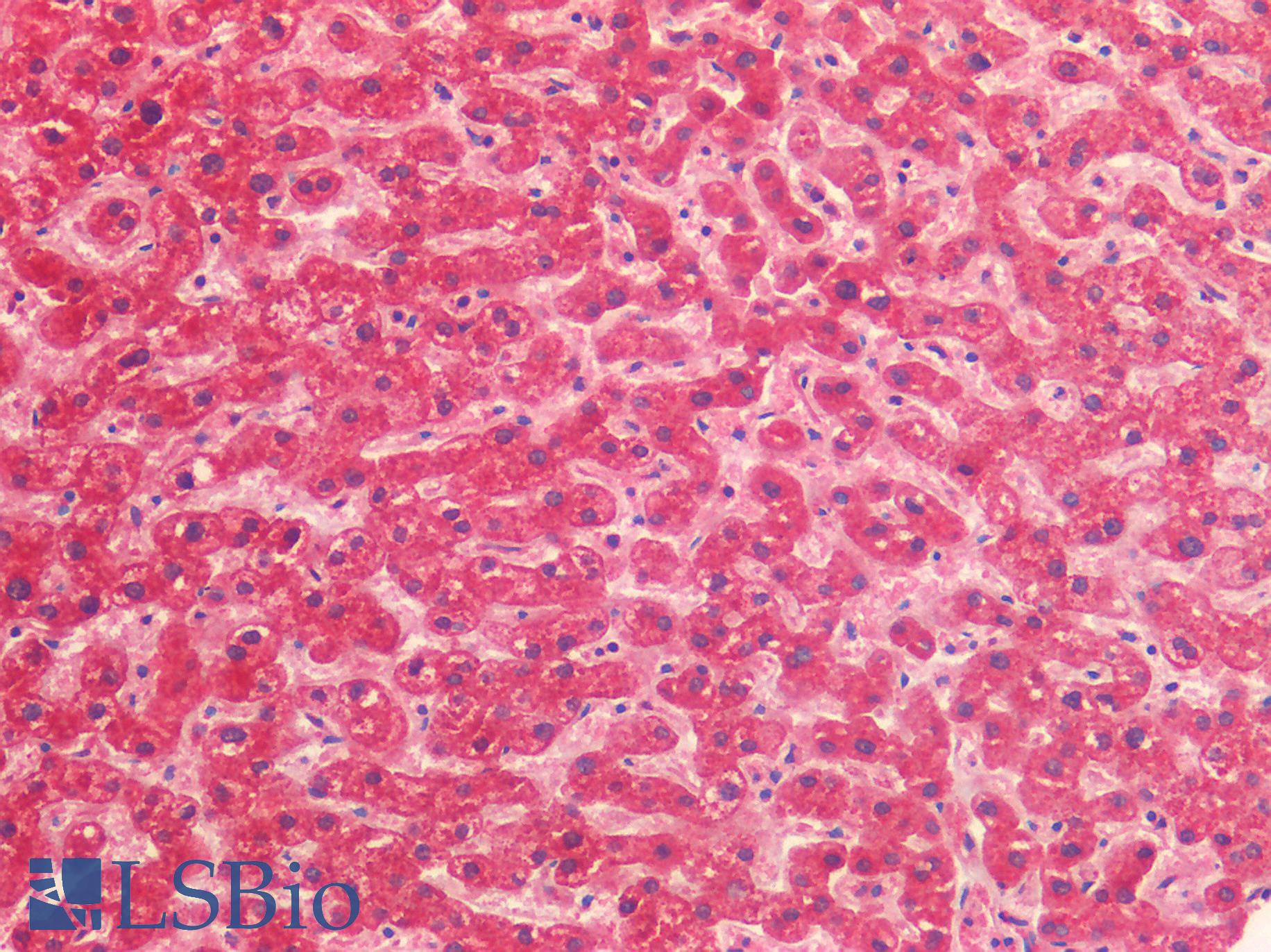 PPIF / Cyclophilin F Antibody - Human Liver: Formalin-Fixed, Paraffin-Embedded (FFPE)