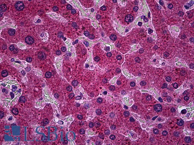 PPM1A / PP2CA Antibody - Anti-PPM1A antibody IHC of human liver. Immunohistochemistry of formalin-fixed, paraffin-embedded tissue after heat-induced antigen retrieval. Antibody concentration 5 ug/ml.