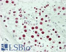 PPM1G Antibody - Human Testis: Formalin-Fixed, Paraffin-Embedded (FFPE)