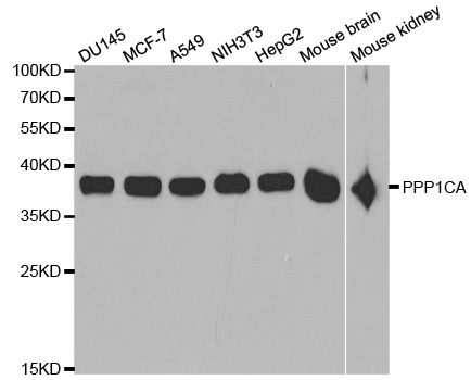 PPP1CA / PP1-Alpha Antibody - Western blot analysis of extracts of various cell lines, using PPP1CA antibody.
