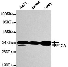 PPP1CA / PP1-Alpha Antibody - Western blot detection of PPP1CA in MCF7, K562, Hela, HEPG2 & Jurkat Whole cell lysates using PPP1CA antibody (1:1000 diluted).