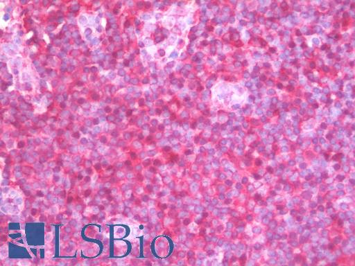 PPP1CA / PP1-Alpha Antibody - Anti-PPP1CA / PP1-Alpha antibody IHC staining of human tonsil. Immunohistochemistry of formalin-fixed, paraffin-embedded tissue after heat-induced antigen retrieval. Antibody dilution 1:50.
