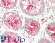 PPP1CB Antibody - Human Colon: Formalin-Fixed, Paraffin-Embedded (FFPE)