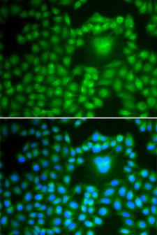 PPP1CB Antibody - Immunofluorescence analysis of U2OS cells.
