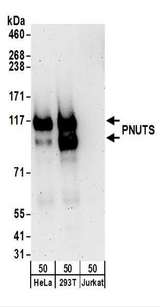 PPP1R10 / PNUTS Antibody - Detection of Human PNUTS by Western Blot. Samples: Whole cell lysate (50 ug) from HeLa, 293T, and Jurkat cells. Antibodies: Affinity purified rabbit anti-PNUTS antibody used for WB at 0.1 ug/ml. Detection: Chemiluminescence with an exposure time of 3 minutes.